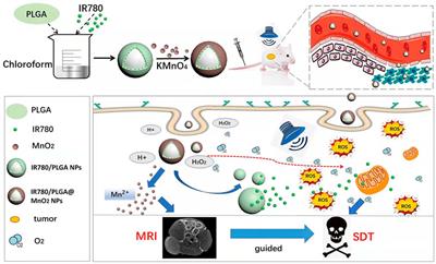 MnO2 coated multi-layer nanoplatform for enhanced sonodynamic therapy and MR imaging of breast cancer